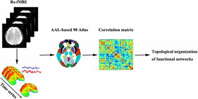 Impaired Topographical Organization of Functional Brain Networks in Parkinson’s Disease Patients With Freezing of Gait